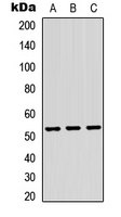 TRMT11 Antibody - Western blot analysis of TRMT11 expression in HEK293T (A); Raw264.7 (B); PC12 (C) whole cell lysates.