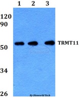 TRMT11 Antibody - Western blot of TRMT11 antibody at 1:500 dilution. Lane 1: HEK293T whole cell lysate. Lane 2: Raw264.7 whole cell lysate. Lane 3: PC12 whole cell lysate.