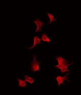 TRMT11 Antibody - Staining HepG2 cells by IF/ICC. The samples were fixed with PFA and permeabilized in 0.1% Triton X-100, then blocked in 10% serum for 45 min at 25°C. The primary antibody was diluted at 1:200 and incubated with the sample for 1 hour at 37°C. An Alexa Fluor 594 conjugated goat anti-rabbit IgG (H+L) Ab, diluted at 1/600, was used as the secondary antibody.