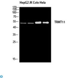 TRMT11 Antibody - Western Blot (WB) analysis of HepG2 JK Colo HeLa using TRMT11 antibody.