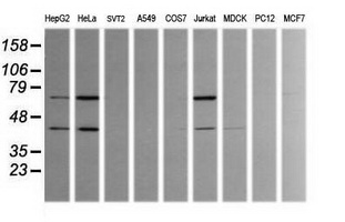 TRMT2A Antibody - Western blot of extracts (35ug) from 9 different cell lines by using anti-TRMT2A monoclonal antibody (HepG2: human; HeLa: human; SVT2: mouse; A549: human; COS7: monkey; Jurkat: human; MDCK: canine; PC12: rat; MCF7: human).