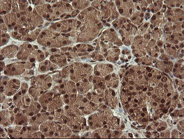 TRMT2A Antibody - IHC of paraffin-embedded Human pancreas tissue using anti-TRMT2A mouse monoclonal antibody. (Heat-induced epitope retrieval by 10mM citric buffer, pH6.0, 120°C for 3min).