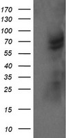 TRMT2A Antibody - HEK293T cells were transfected with the pCMV6-ENTRY control (Left lane) or pCMV6-ENTRY TRMT2A (Right lane) cDNA for 48 hrs and lysed. Equivalent amounts of cell lysates (5 ug per lane) were separated by SDS-PAGE and immunoblotted with anti-TRMT2A.