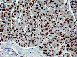 TRMT2A Antibody - IHC of paraffin-embedded Human pancreas tissue using anti-TRMT2A mouse monoclonal antibody.