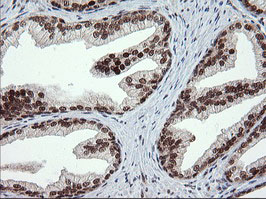 TRMT2A Antibody - IHC of paraffin-embedded Human prostate tissue using anti-TRMT2A mouse monoclonal antibody.