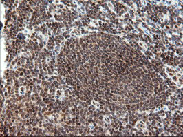 TRMT2A Antibody - IHC of paraffin-embedded Human tonsil using anti-TRMT2A mouse monoclonal antibody.