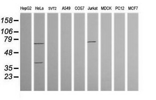 TRMT2A Antibody - Western blot of extracts (35 ug) from 9 different cell lines by using g anti-TRMT2A monoclonal antibody (HepG2: human; HeLa: human; SVT2: mouse; A549: human; COS7: monkey; Jurkat: human; MDCK: canine; PC12: rat; MCF7: human).