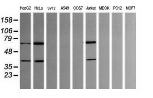 TRMT2A Antibody - Western blot of extracts (35 ug) from 9 different cell lines by using g anti-TRMT2A monoclonal antibody (HepG2: human; HeLa: human; SVT2: mouse; A549: human; COS7: monkey; Jurkat: human; MDCK: canine; PC12: rat; MCF7: human).