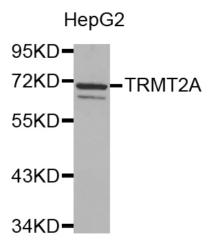 TRMT2A Antibody - Western blot analysis of extracts of HepG2 cell lines, using TRMT2A antibody.