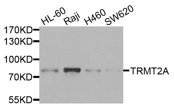 TRMT2A Antibody - Western blot analysis of extracts of various cells.