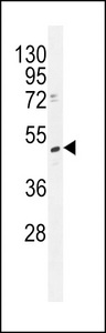 TRMT2B Antibody - TRMT2B Antibody western blot of K562 cell line lysates (35 ug/lane). The TRMT2B antibody detected the TRMT2B protein (arrow).
