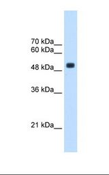 TRMT2B Antibody - HepG2 cell lysate. Antibody concentration: 2.5 ug/ml. Gel concentration: 12%.  This image was taken for the unconjugated form of this product. Other forms have not been tested.