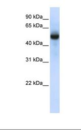 TRMT2B Antibody - Fetal brain lysate. Antibody concentration: 1.0 ug/ml. Gel concentration: 12%.  This image was taken for the unconjugated form of this product. Other forms have not been tested.