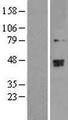 TRMT2B Protein - Western validation with an anti-DDK antibody * L: Control HEK293 lysate R: Over-expression lysate