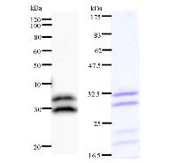 TRMT61A / TRM61 Antibody - Left : Western blot analysis of immunized recombinant protein, using anti-C14orf172 monoclonal antibody. Right : CBB staining of immunized recombinant protein.