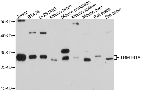 TRMT61A / TRM61 Antibody - Western blot analysis of extracts of various cell lines, using TRMT61A antibody at 1:1000 dilution. The secondary antibody used was an HRP Goat Anti-Rabbit IgG (H+L) at 1:10000 dilution. Lysates were loaded 25ug per lane and 3% nonfat dry milk in TBST was used for blocking. An ECL Kit was used for detection and the exposure time was 10s.