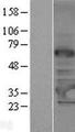 TRMT61A / TRM61 Protein - Western validation with an anti-DDK antibody * L: Control HEK293 lysate R: Over-expression lysate