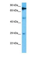 TRMT61B Antibody - Western blot of TRMT61B Antibody with human HeLa Whole Cell lysate.  This image was taken for the unconjugated form of this product. Other forms have not been tested.
