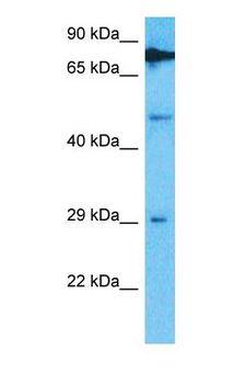TRMT61B Antibody - Western blot of TRMT61B Antibody with human HeLa Whole Cell lysate.  This image was taken for the unconjugated form of this product. Other forms have not been tested.