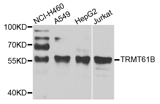TRMT61B Antibody - Western blot analysis of extracts of various cell lines.