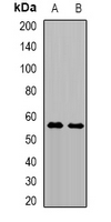 TRMT61B Antibody - Western blot analysis of TRMT61B expression in A549 (A); Jurkat (B) whole cell lysates.