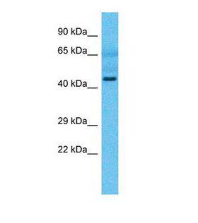 TRMU Antibody - Western blot of Human Lung Tumor. TRMU antibody dilution 1.0 ug/ml.  This image was taken for the unconjugated form of this product. Other forms have not been tested.