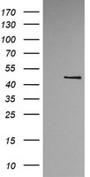 TRMU Antibody - HEK293T cells were transfected with the pCMV6-ENTRY control (Left lane) or pCMV6-ENTRY TRMU (Right lane) cDNA for 48 hrs and lysed. Equivalent amounts of cell lysates (5 ug per lane) were separated by SDS-PAGE and immunoblotted with anti-TRMU.