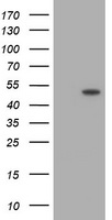 TRMU Antibody - HEK293T cells were transfected with the pCMV6-ENTRY control (Left lane) or pCMV6-ENTRY TRMU (Right lane) cDNA for 48 hrs and lysed. Equivalent amounts of cell lysates (5 ug per lane) were separated by SDS-PAGE and immunoblotted with anti-TRMU.