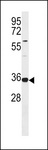 TRNAU1AP / TRSPAP1 Antibody - TRNAU1AP Antibody western blot of Jurkat cell line lysates (35 ug/lane). The TRNAU1AP antibody detected the TRNAU1AP protein (arrow).