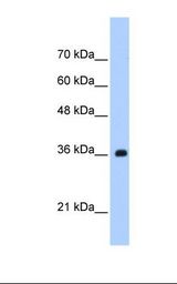 TRNAU1AP / TRSPAP1 Antibody - Jurkat cell lysate. Antibody concentration: 1.25 ug/ml. Gel concentration: 12%.  This image was taken for the unconjugated form of this product. Other forms have not been tested.