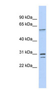 TRNAU1AP / TRSPAP1 Antibody - TRNAU1AP / TRSPAP1 antibody Western blot of Fetal Intestine lysate. This image was taken for the unconjugated form of this product. Other forms have not been tested.