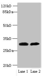 TRNAU1AP / TRSPAP1 Antibody - Western blot All lanes: TRNAU1AP antibody at 12µg/ml Lane 1: MCF-7 whole cell lysate Lane 2: Jurkat whole cell lysate Secondary Goat polyclonal to rabbit IgG at 1/10000 dilution Predicted band size: 33, 21 kDa Observed band size: 33 kDa