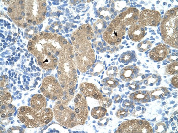TRNT1 / CCA1 Antibody - TRNT1 antibody ARP40819_T100-NP_057084-TRNT1 (tRNA nucleotidyl transferase, CCA-adding, 1) Antibody was used in IHC to stain formalin-fixed, paraffin-embedded human kidney.  This image was taken for the unconjugated form of this product. Other forms have not been tested.