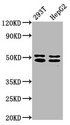 TRNT1 / CCA1 Antibody - Western Blot Positive WB detected in: 293T whole cell lysate, HepG2 whole cell lysate All Lanes: TRNT1 antibody at 5µg/ml Secondary Goat polyclonal to rabbit IgG at 1/50000 dilution Predicted band size: 51, 48, 7 KDa Observed band size: 51, 48 KDa