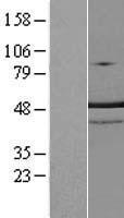 TRNT1 / CCA1 Protein - Western validation with an anti-DDK antibody * L: Control HEK293 lysate R: Over-expression lysate