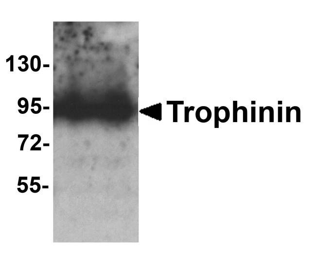 TRO / Trophonin Antibody - Western blot analysis of Trophinin in rat liver tissue lysate with Trophinin antibody at 1 ug/ml.