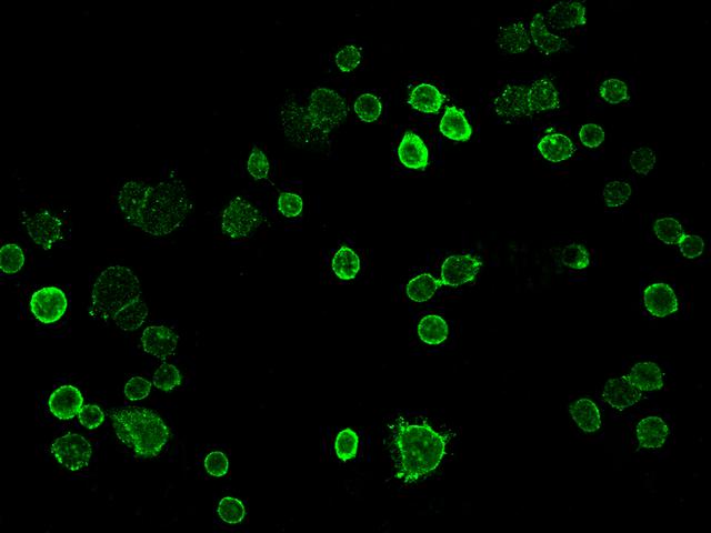 TROP2 / TACSTD2 Antibody - Immunofluorescence staining of TROP2 in SKBR3 cells. Cells were fixed with 4% PFA, blocked with 10% serum, and incubated with rabbit anti-human TROP2 monoclonal antibody (dilution ratio 1:60) at 4°C overnight. Then cells were stained with the Alexa Fluor 488-conjugated Goat Anti-rabbit IgG secondary antibody (green).
