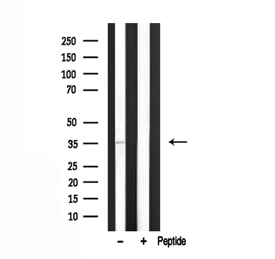 TROP2 / TACSTD2 Antibody - Western blot analysis of TACD2 expression in mouse muscle lysate