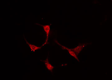TROP2 / TACSTD2 Antibody - Staining A549 cells by IF/ICC. The samples were fixed with PFA and permeabilized in 0.1% Triton X-100, then blocked in 10% serum for 45 min at 25°C. The primary antibody was diluted at 1:200 and incubated with the sample for 1 hour at 37°C. An Alexa Fluor 594 conjugated goat anti-rabbit IgG (H+L) antibody, diluted at 1/600, was used as secondary antibody.