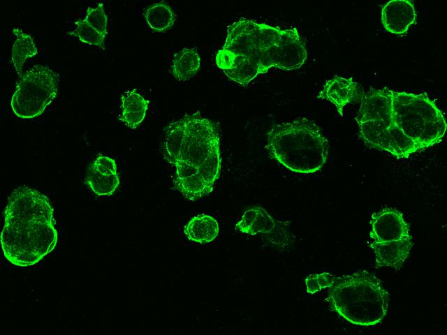 TROP2 / TACSTD2 Antibody - Immunofluorescence staining of TACSTD2 in MCF7 cells. Cells were fixed with 4% PFA, blocked with 10% serum, and incubated with rabbit anti-Human TACSTD2 polyclonal antibody (dilution ratio 1:1000) at 4°C overnight. Then cells were stained with the Alexa Fluor 488-conjugated Goat Anti-rabbit IgG secondary antibody (green). Positive staining was localized to Cell membrane.
