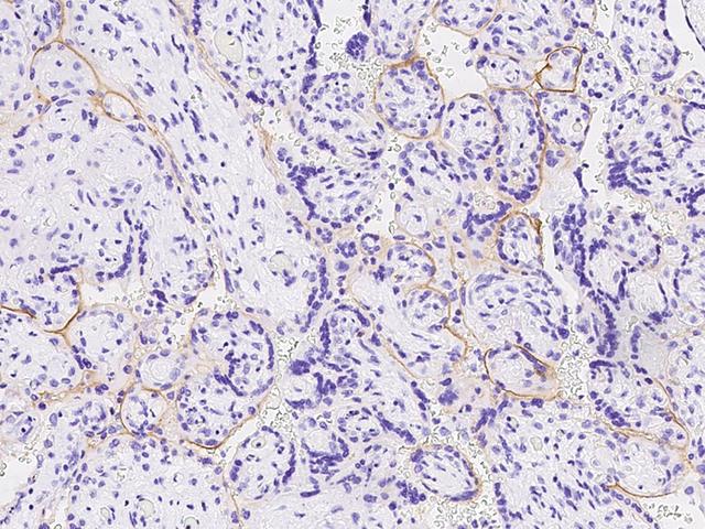 TROP2 / TACSTD2 Antibody - Immunochemical staining of human TROP2 in human placenta with rabbit polyclonal antibody at 1:1000 dilution, formalin-fixed paraffin embedded sections.