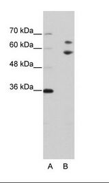 TROVE2 Antibody - A: Marker, B: Jurkat Cell Lysate.  This image was taken for the unconjugated form of this product. Other forms have not been tested.