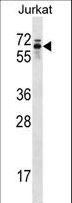 TROVE2 Antibody - TROVE2 Antibody western blot of Jurkat cell line lysates (35 ug/lane). The TROVE2 antibody detected the TROVE2 protein (arrow).