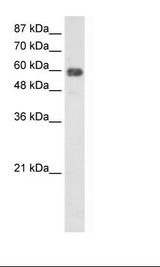 TROVE2 Antibody - HepG2 Cell Lysate.  This image was taken for the unconjugated form of this product. Other forms have not been tested.