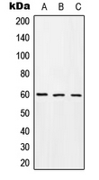 TROVE2 Antibody - Western blot analysis of TROVE2 expression in Jurkat (A); mouse brain (B); rat brain (C) whole cell lysates.