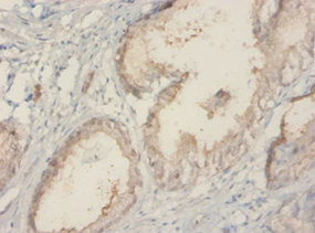 TROVE2 Antibody - Immunohistochemistry of paraffin-embedded human prostate tissue using TROVE2 Antibody at dilution of 1:20