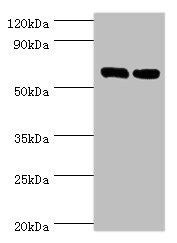 TROVE2 Antibody - Western blot All lanes: TROVE2 antibody at 2µg/ml Lane 1: Hela whole cell lysate Lane 2: 293T whole cell lysate Secondary Goat polyclonal to rabbit IgG at 1/10000 dilution Predicted band size: 61, 24, 59, 60 kDa Observed band size: 61 kDa