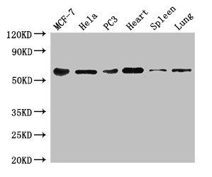 TROVE2 Antibody - Western Blot Positive WB detected in: MCF-7 whole cell lysate, Hela whole cell lysate, PC-3 whole cell lysate, Mouse heart tissue, Mouse spleen tissue, Mouse lung tissue All lanes: TROVE2 antibody at 3µg/ml Secondary Goat polyclonal to rabbit IgG at 1/50000 dilution Predicted band size: 61, 24, 59, 60 kDa Observed band size: 61 kDa