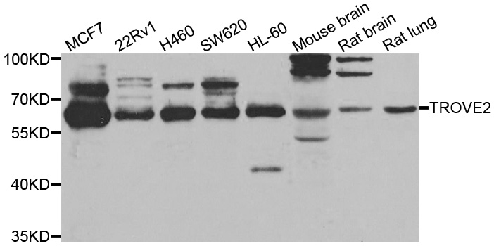 TROVE2 Antibody - Western blot analysis of extracts of various cell lines.