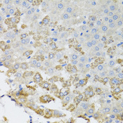 TROVE2 Antibody - Immunohistochemistry of paraffin-embedded rat liver tissue.
